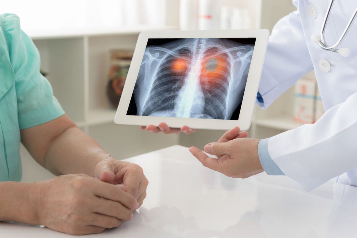 Bantu Deteksi Kanker Lebih Akurat, AstraZeneca dan RS Kanker Dharmais Berkolaborasi Terapkan NGS